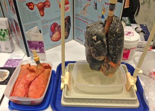 Effects of smoking on the lungs