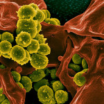 Research Aims to Develop New Treatments for MRSA Infections
