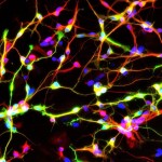 Researchers Take Huge Steps in Fight Against Parkinson’s