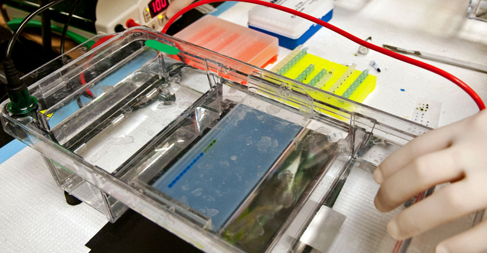 DNA Agarose gel electrophoresis lab test